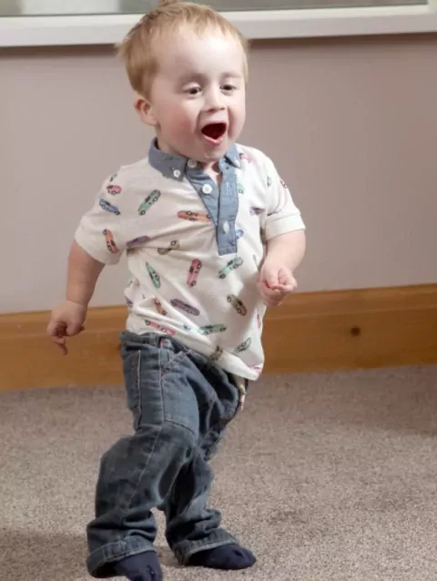 Броуди Лэнд — Единственный ребенок в Великобритании с редкой формой карликовости